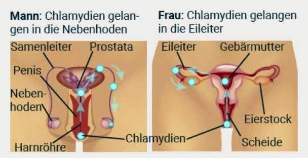 Chlamydienverbreitung bei Mann und Frau