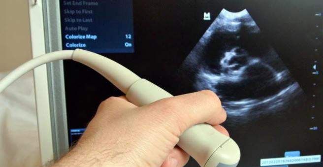 negimdinis nėštumas, pilvo ertmės nėštumas