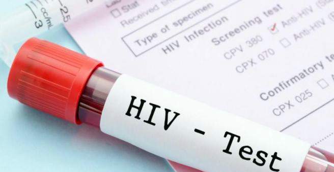 HIV-testi