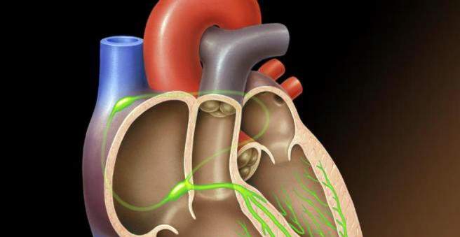 aortaklep stenose