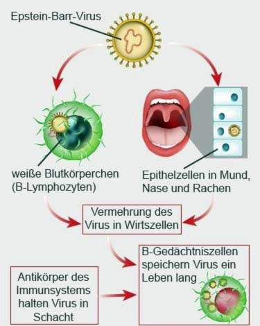 Epstein-Barr virus infection