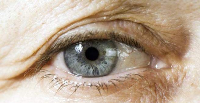 Diabetische retinopathie