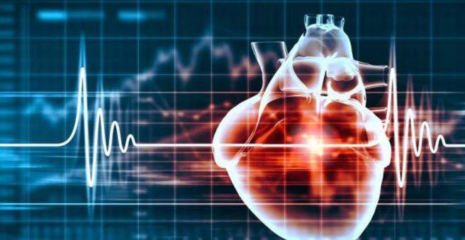 Širdies ritmo sutrikimai
